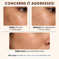 Niacinamide Glow Serum – Pack of 2 | Niacinamide Serum for Oily & Acne-Prone Skin
