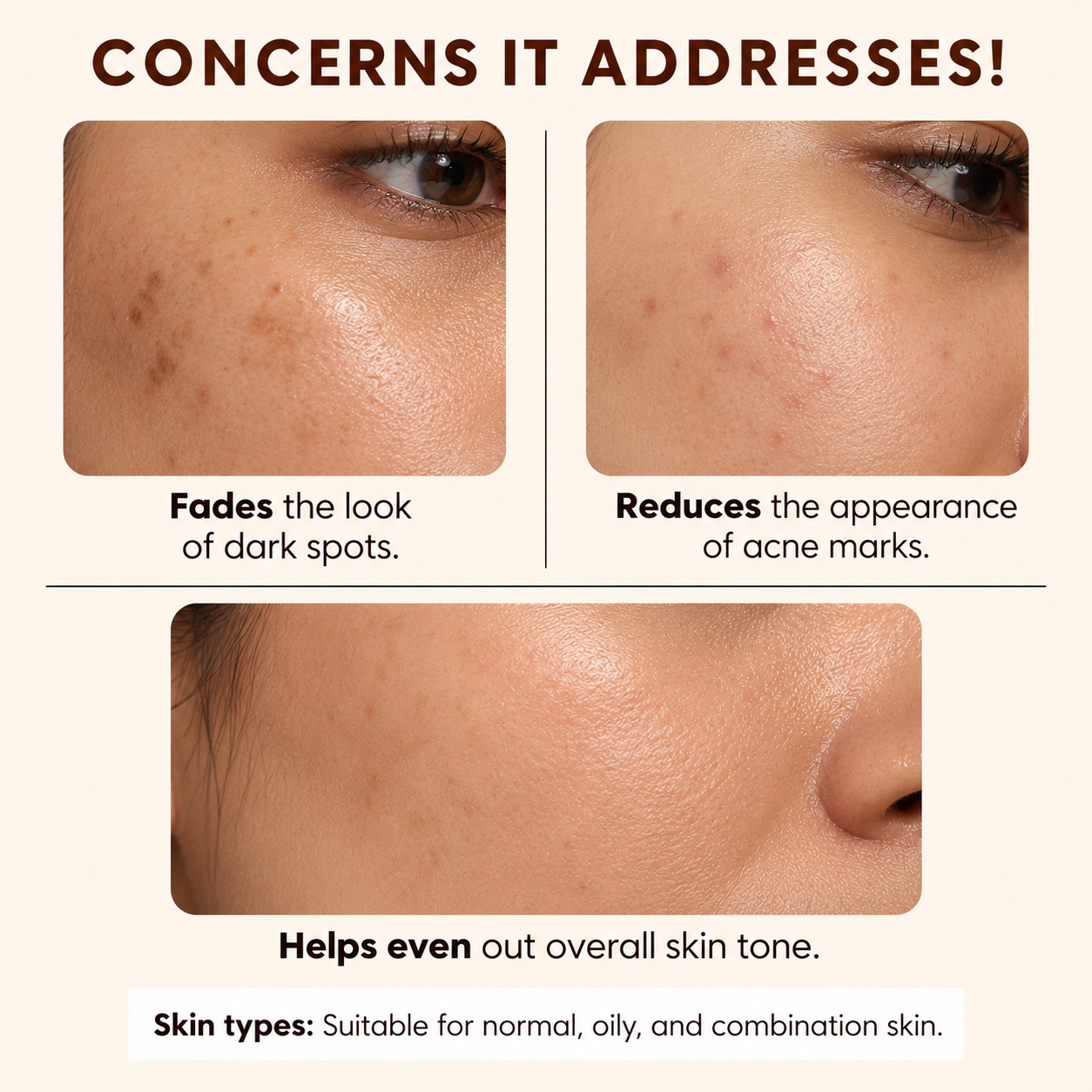 Niacinamide Glow Serum – Pack of 2 | Niacinamide Serum for Oily & Acne-Prone Skin