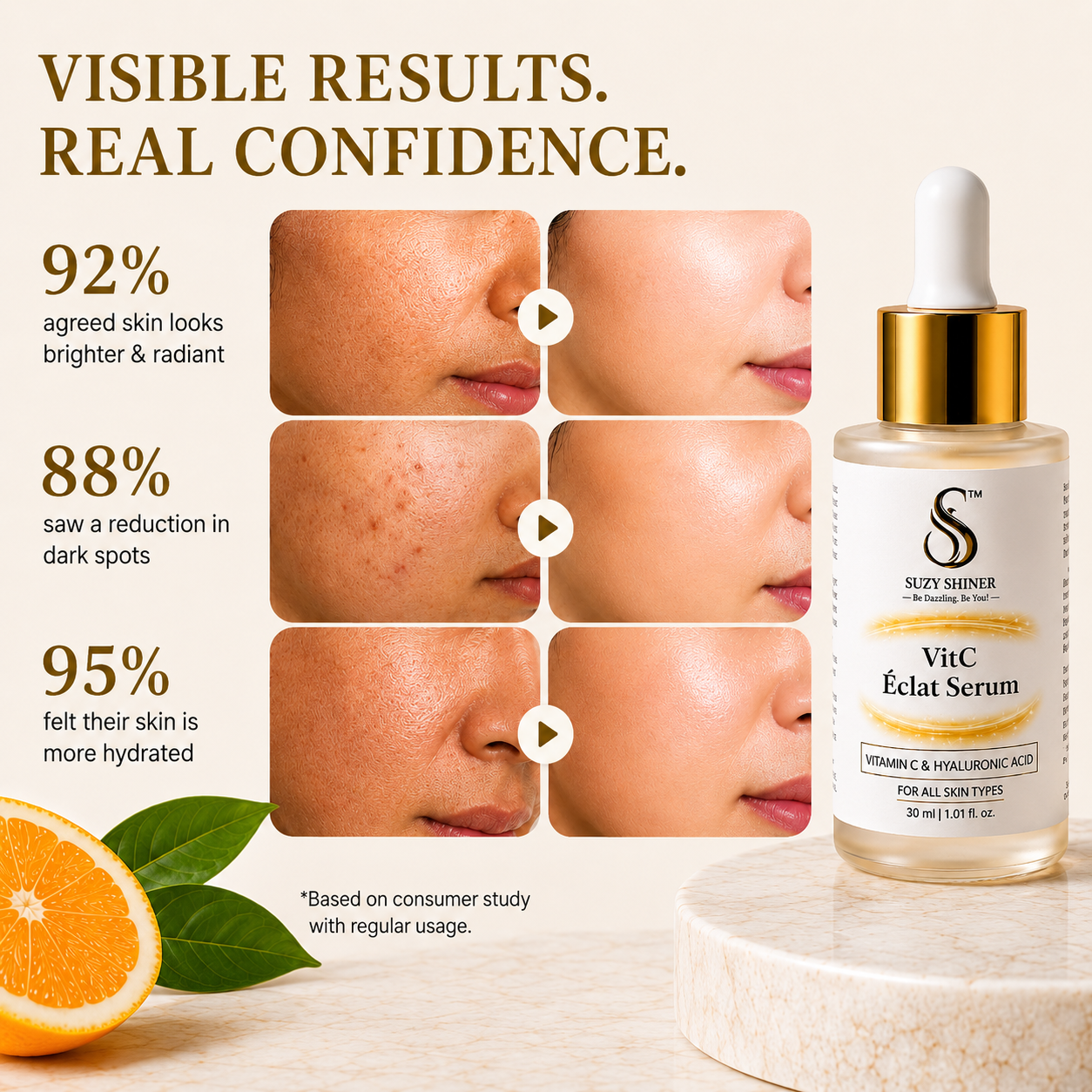 Results after continuous usage of Vit-C Éclat Vitamin C Serum 